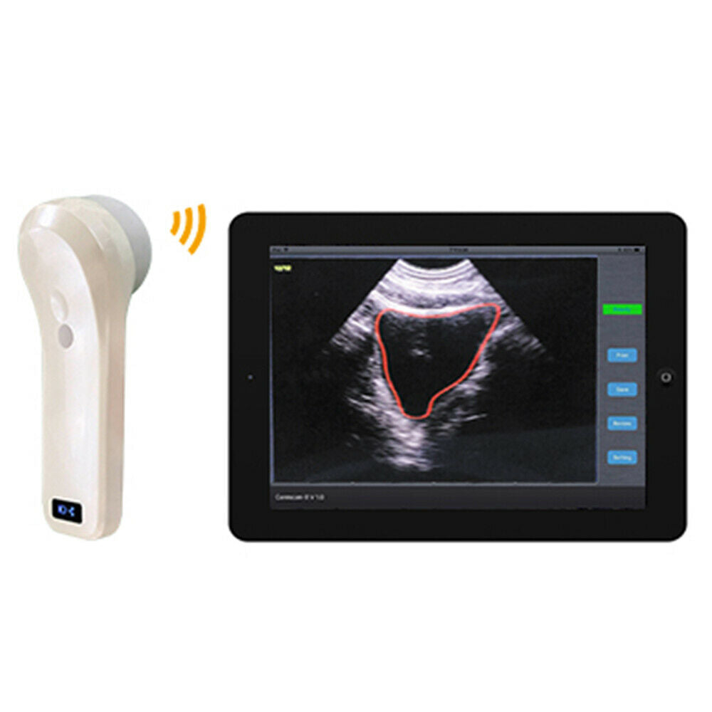 Portable Handheld 4D Scan/Array Probe Wireless Probe Bladder Ultrasound Scanner DIAGNOSTIC ULTRASOUND MACHINES FOR SALE
