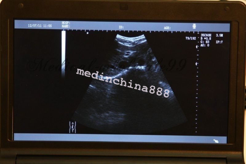 New 10.1'' Ultrasound Scanner With Convex+Linear+Transvaginal+Micro-convex Probe DIAGNOSTIC ULTRASOUND MACHINES FOR SALE