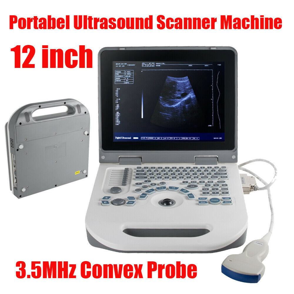 Portable Laptop Digital Ultrasound Scanner Machine System +Convex Probe +Battery DIAGNOSTIC ULTRASOUND MACHINES FOR SALE