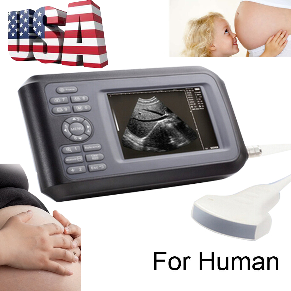 Medical Handheld Ultrasound Scanner Machine With Convex Transducer For Human USA DIAGNOSTIC ULTRASOUND MACHINES FOR SALE