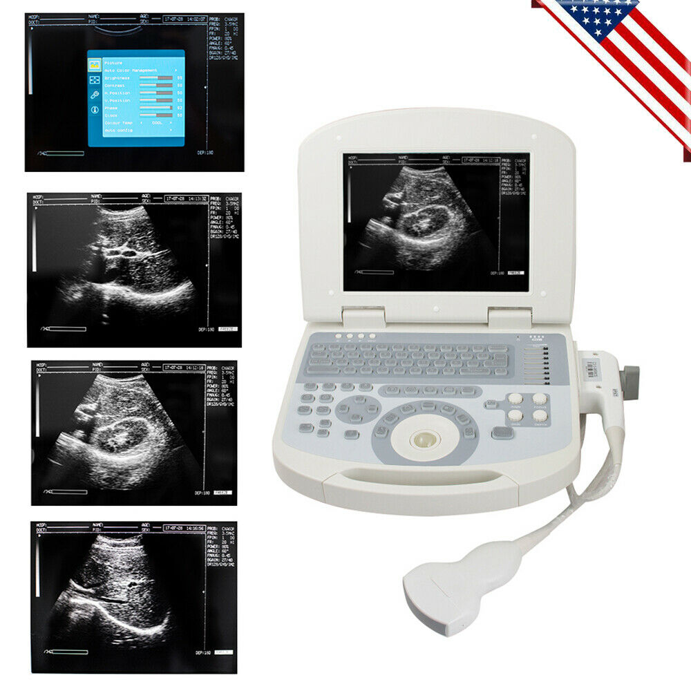 Portable 10.4in Full Digital Laptop Medical Ultrasound Scanner 3.5 Convex Probe DIAGNOSTIC ULTRASOUND MACHINES FOR SALE