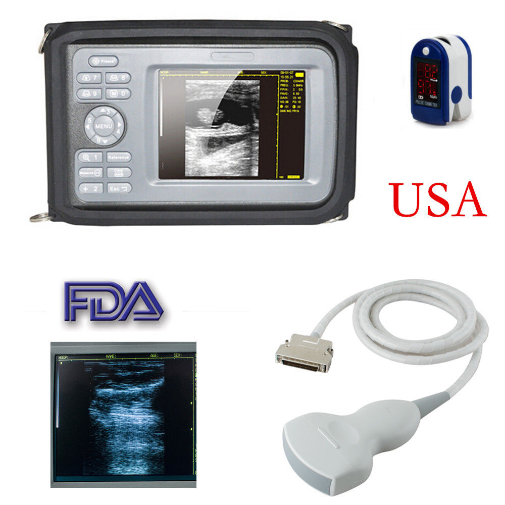 Portable HandScan 5.5'' Digital Ultrasound Scanner Machine+Convex Probe+Oximeter 190891400826 DIAGNOSTIC ULTRASOUND MACHINES FOR SALE