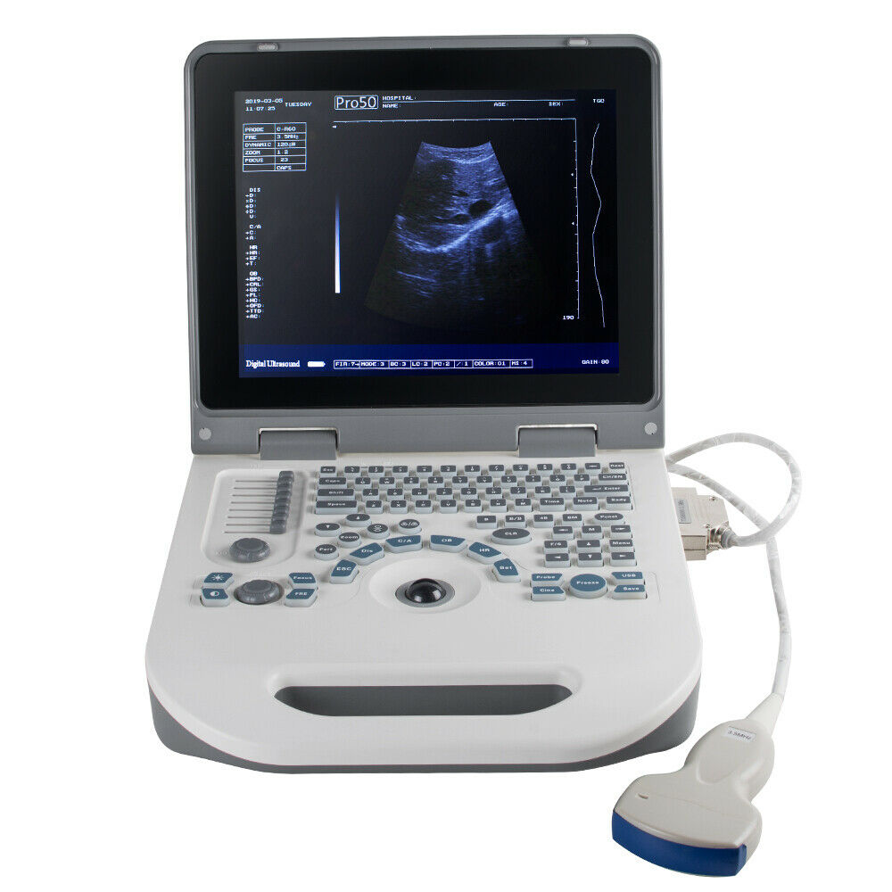 Portable Laptop Digital Ultrasound Scanner Machine System +Convex Probe +Battery DIAGNOSTIC ULTRASOUND MACHINES FOR SALE