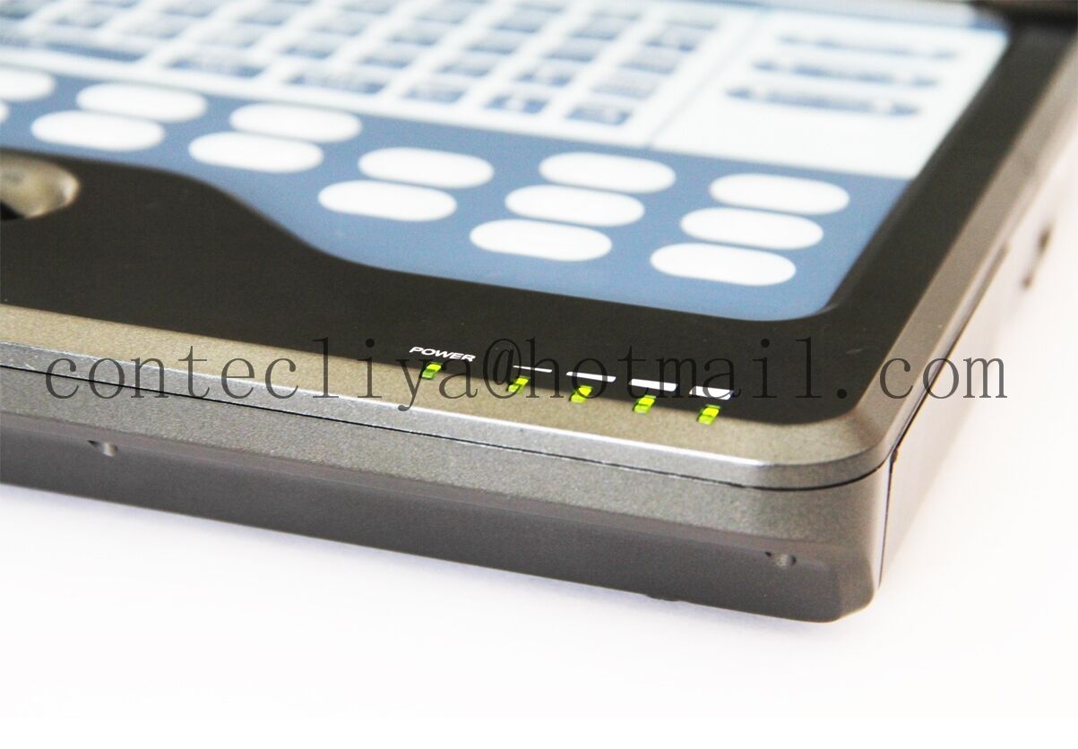 Portable Laptop Ultrasound Scanner Machine+2 Probes,Digital Diagnostic System,CE DIAGNOSTIC ULTRASOUND MACHINES FOR SALE