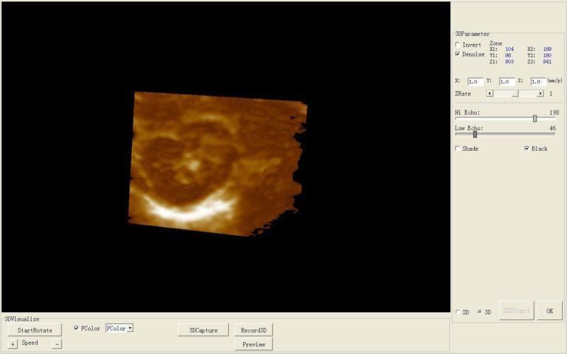 Digital Ultrasound Scanner/Machine 3.5Mhz Convex Transducer/Probe 3D A+ DIAGNOSTIC ULTRASOUND MACHINES FOR SALE