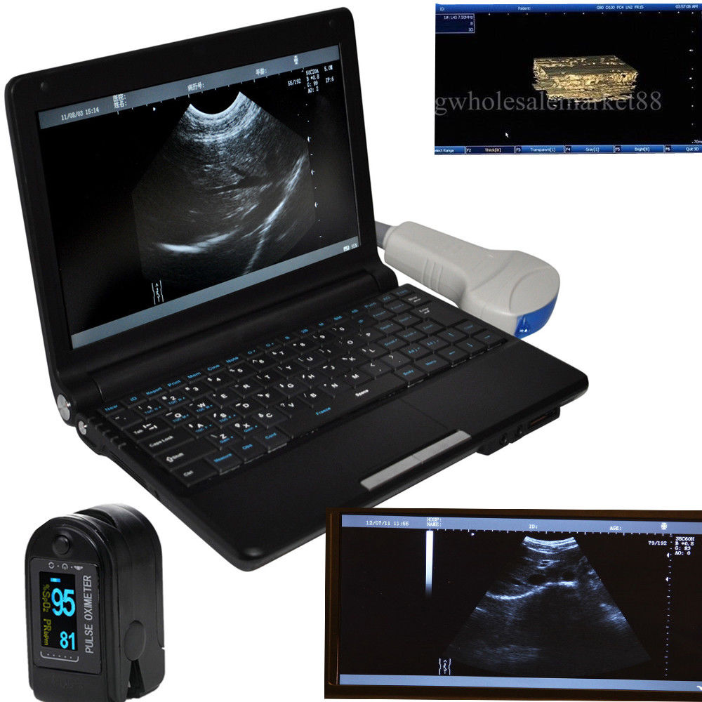 Digital Portable Ultrasound Machine Scanner Convex Probe+ 3D Oximeter 1024 Image DIAGNOSTIC ULTRASOUND MACHINES FOR SALE