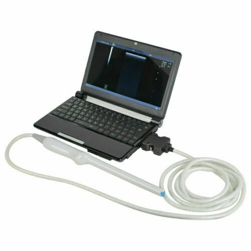 Digital Laptop Ultrasound Scanner with Transvaginal Micro Convex 2 Probes Fast DIAGNOSTIC ULTRASOUND MACHINES FOR SALE