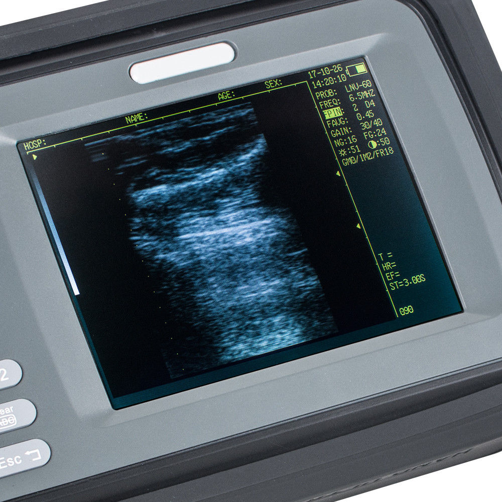 Factory Handheld PalmSmart Ultrasound Scanner/Machine Cardiac Micro-Convex Probe DIAGNOSTIC ULTRASOUND MACHINES FOR SALE