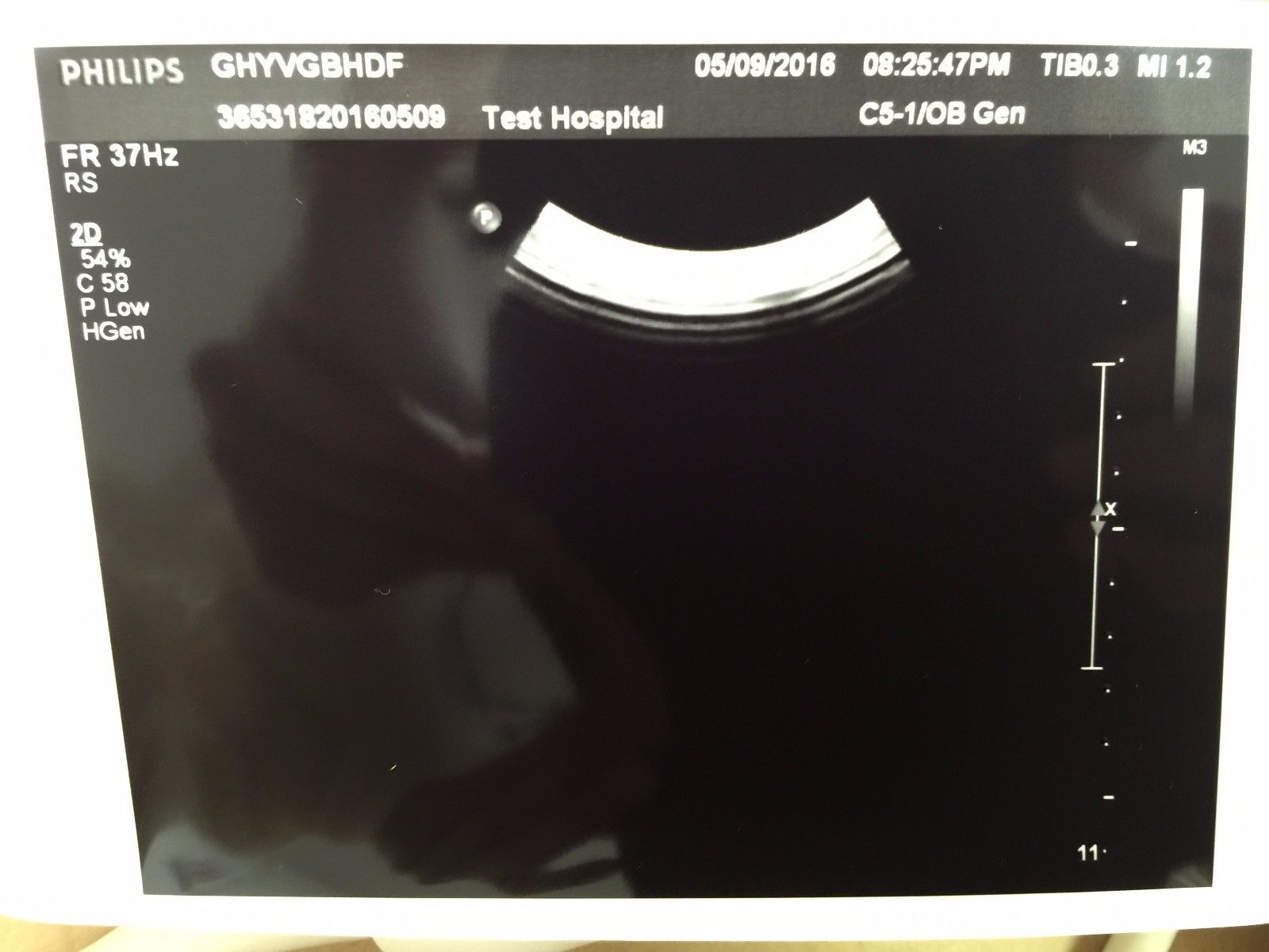 Philips C5-1 Convex Ultrasound Transducer  for Philips iU22 Systems DIAGNOSTIC ULTRASOUND MACHINES FOR SALE