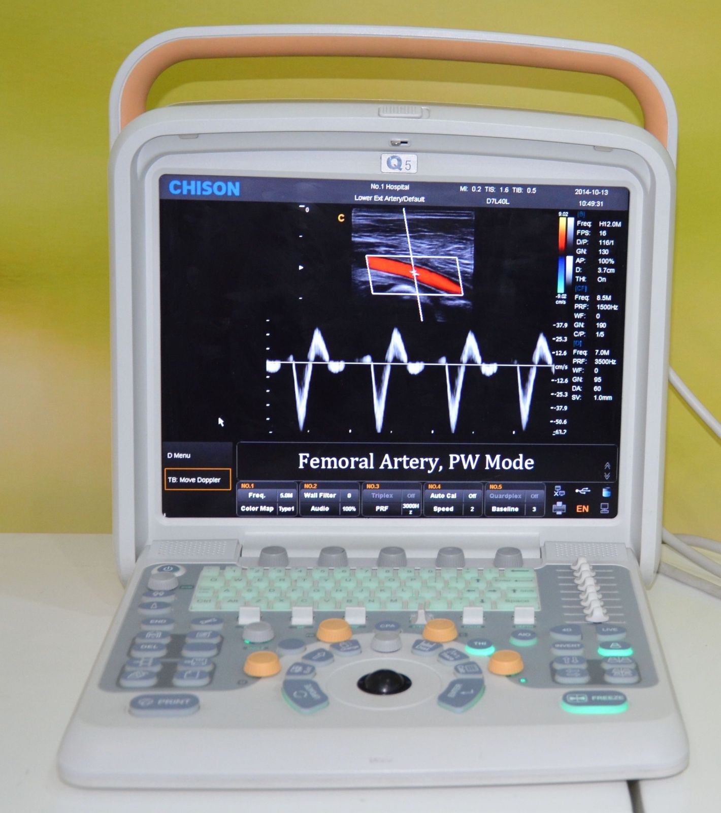 Color Doppler Ultrasound Chison Q5, 4D Probe-Obstetrics Gynecology New Warranty DIAGNOSTIC ULTRASOUND MACHINES FOR SALE