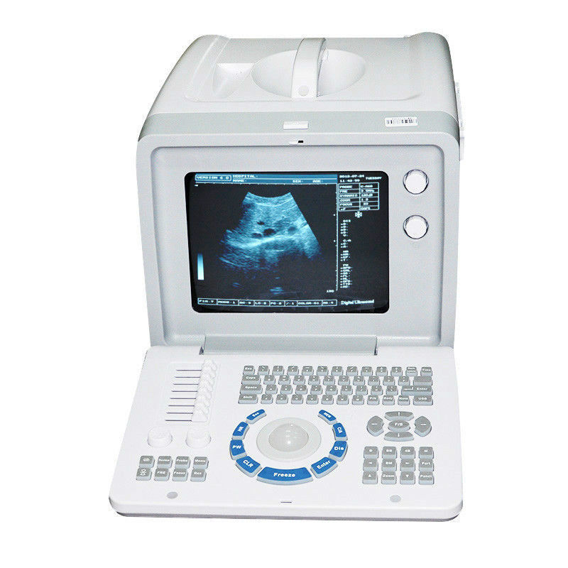 New Ultrasound Scanner Machine Convex +Transvaginal 2 Probe 3D Dynamic real-time 190891422446 DIAGNOSTIC ULTRASOUND MACHINES FOR SALE