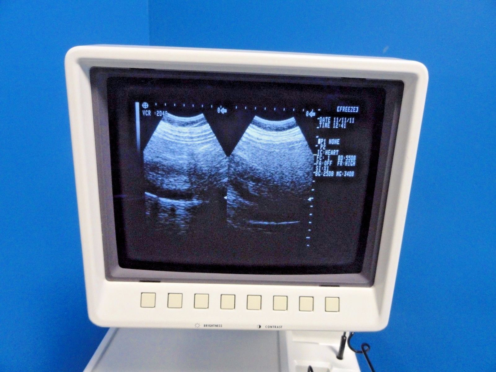 Shimadzu VA40R-035U 3.5 MHz 40mm Convex Probe for SDU-1100 SDU-400 SDU-450~13538 DIAGNOSTIC ULTRASOUND MACHINES FOR SALE