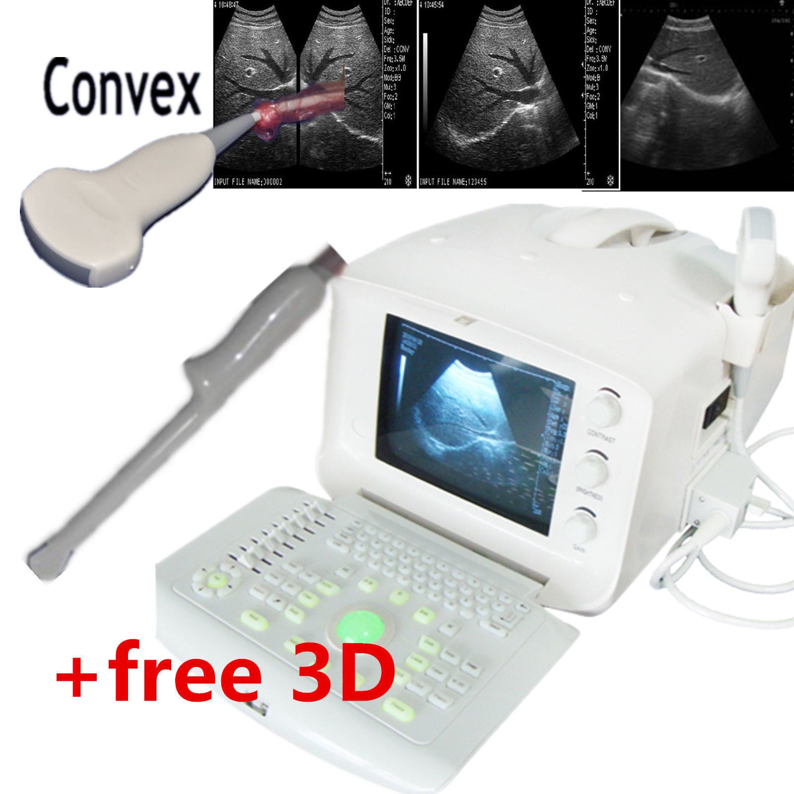 LCD 3D Image Digital Ultrasound Scanner Monitor Convex Transvaginal Probes USB DIAGNOSTIC ULTRASOUND MACHINES FOR SALE