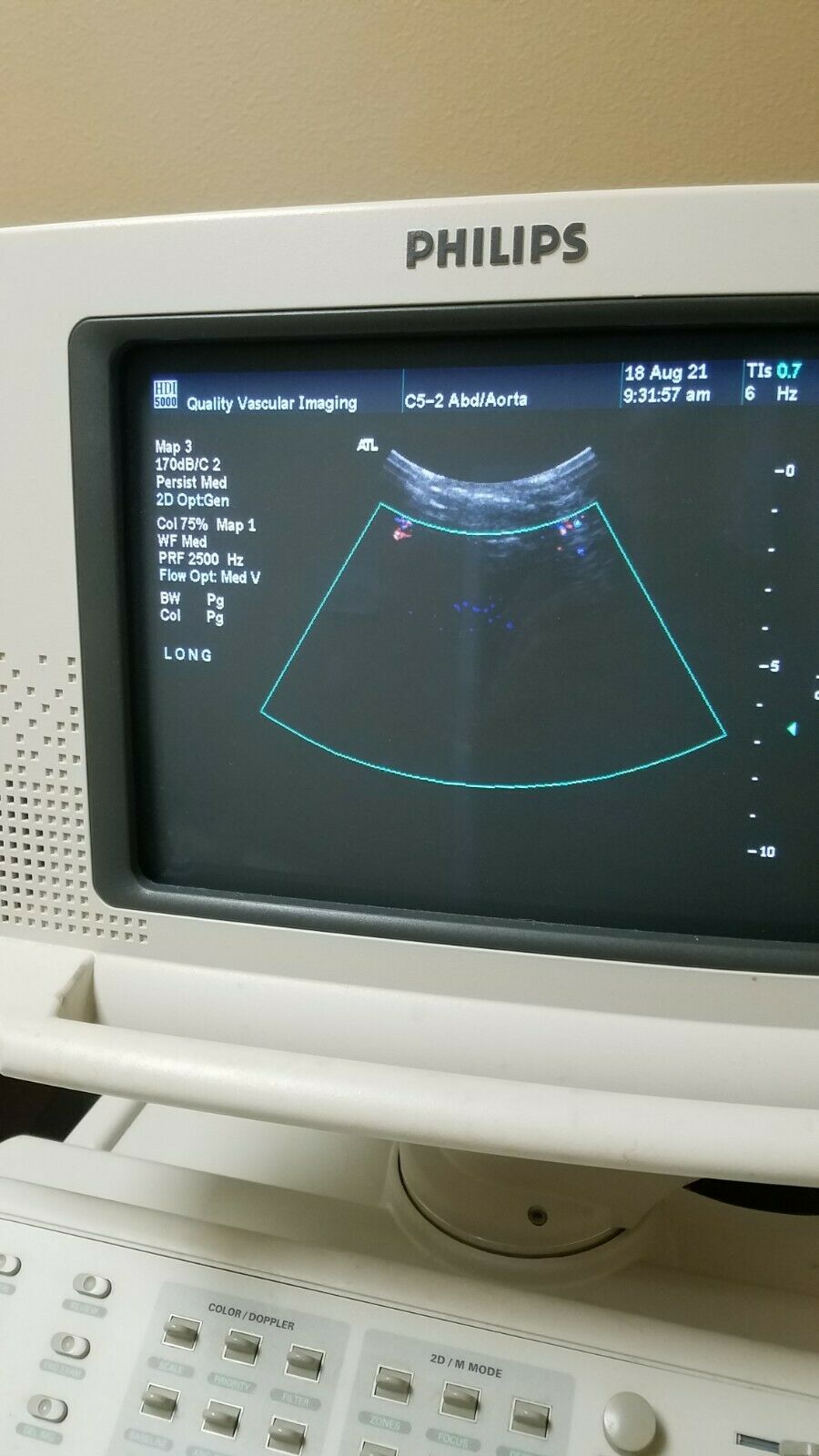 Phillips HDI 5000 Ultrasound Instrument DIAGNOSTIC ULTRASOUND MACHINES FOR SALE