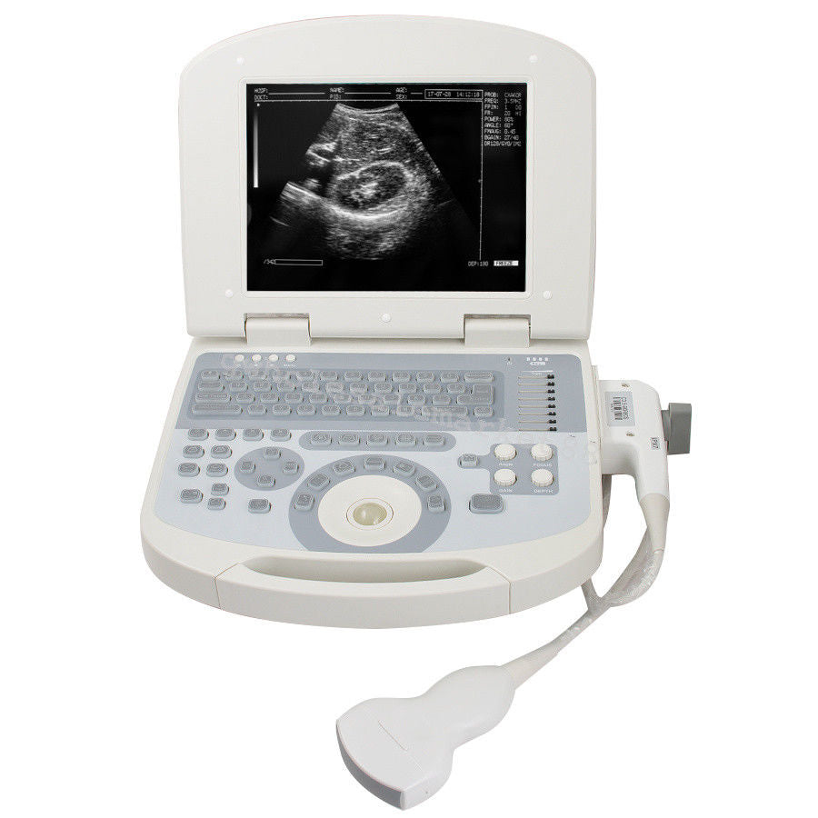 Portable Ultrasound Machine Scanner System Convex probe 3D Software Image Photo 190891045898 DIAGNOSTIC ULTRASOUND MACHINES FOR SALE