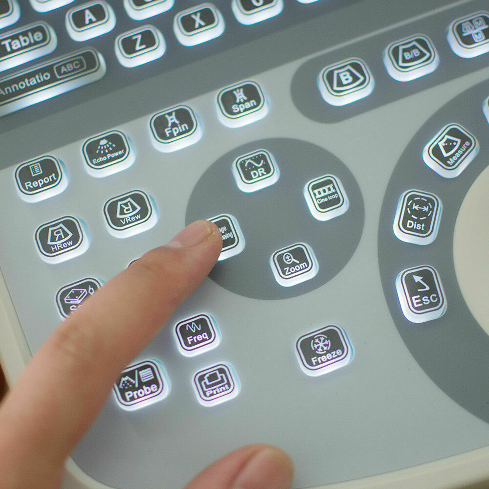 New Portable Notebook Digital Laptop Machine Ultrasound Scanner Convex Probe+3D DIAGNOSTIC ULTRASOUND MACHINES FOR SALE