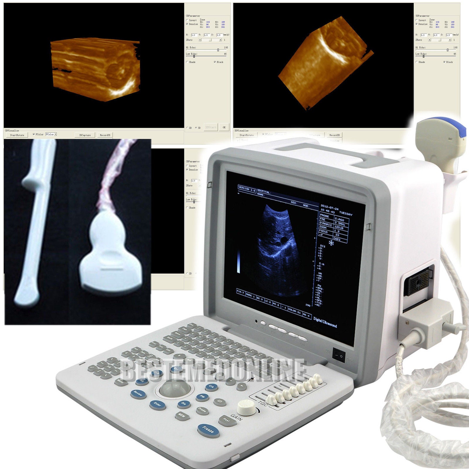 Portable Ultrasound Machine Scanner System Convex Probe+Transvaginal 3D Version 190891055620 DIAGNOSTIC ULTRASOUND MACHINES FOR SALE