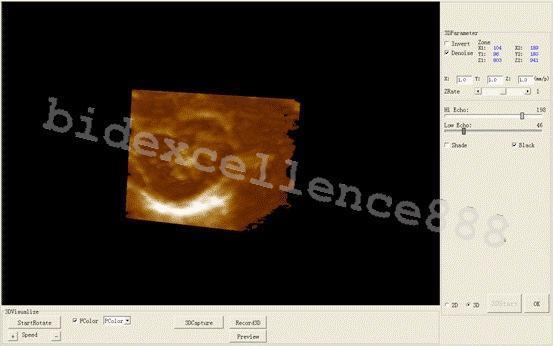 Portable Laptop Ultrasound Scanner Diagnostic machine Convex Probe 3D OximeterAA 190891895424 DIAGNOSTIC ULTRASOUND MACHINES FOR SALE