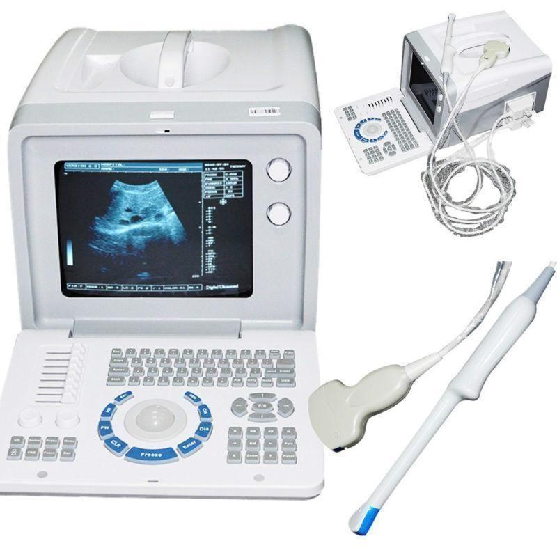 Digital Portable Ultrasound Scanner convex&Transvaginal Probe Optional Trolly AA DIAGNOSTIC ULTRASOUND MACHINES FOR SALE