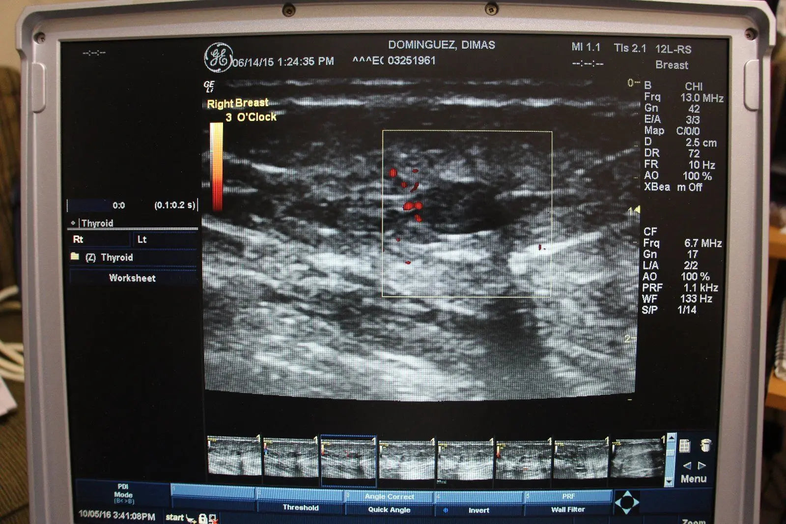 Portable Ultrasound Machine GE LOGIQ i 2007 with 2 Transducers DIAGNOSTIC ULTRASOUND MACHINES FOR SALE