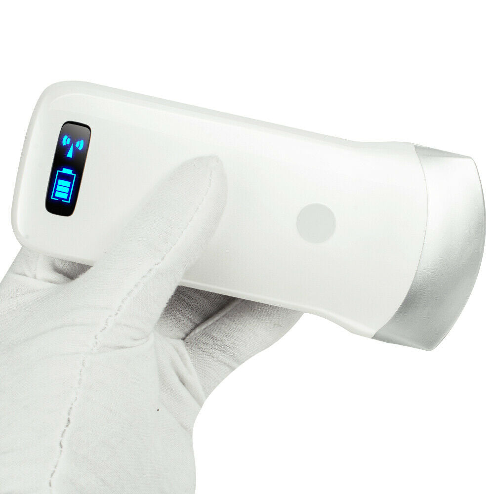 Portable Ultrasound Scanner Convex Array Probe 3.5Mhz 80 Elements +16 Channel CE DIAGNOSTIC ULTRASOUND MACHINES FOR SALE