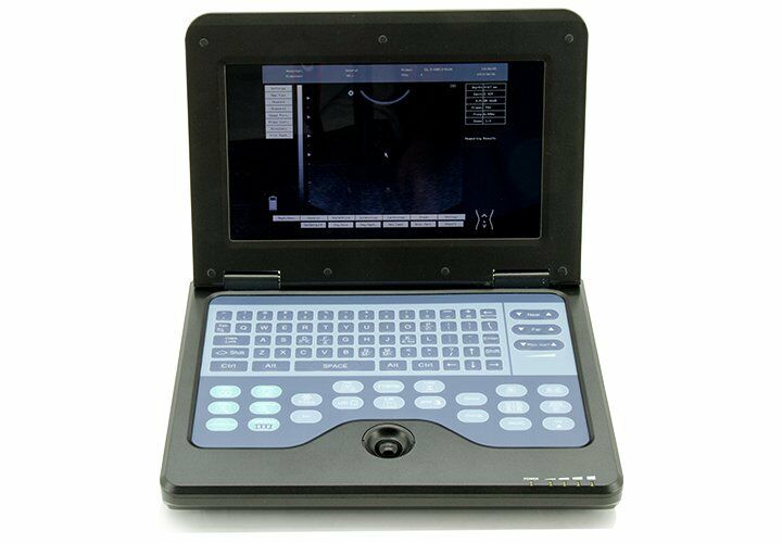 Newest Digital Portable Laptop Ultrasound Scanner Machine,7.5MHz Linear probe US 658126883672 DIAGNOSTIC ULTRASOUND MACHINES FOR SALE