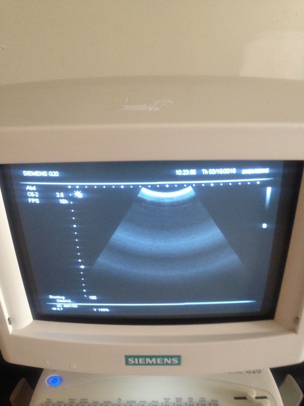 Siemens Sonoline G20 Ultrasound  C5-2 Probe  & Printer  OB-GYN, Urology DIAGNOSTIC ULTRASOUND MACHINES FOR SALE