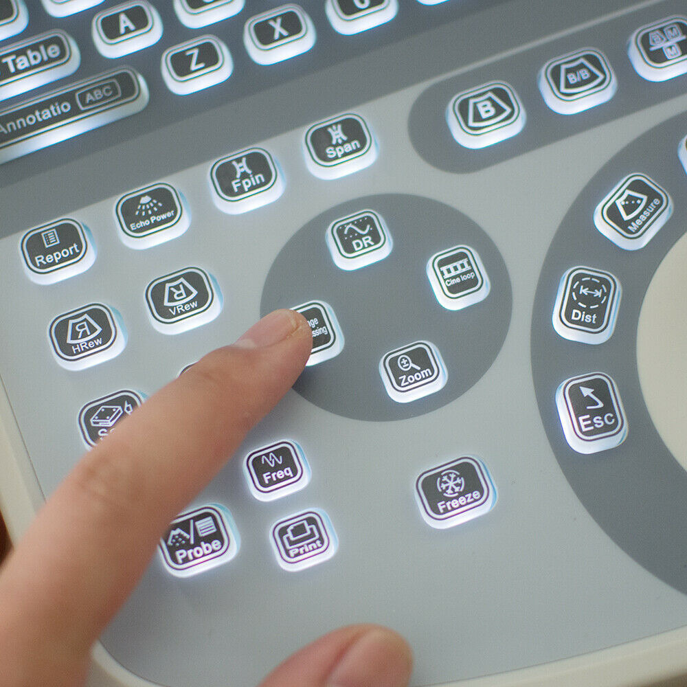 Portable laptop machine Full Digital Ultrasound Ultrasonic scanner Convex probe DIAGNOSTIC ULTRASOUND MACHINES FOR SALE