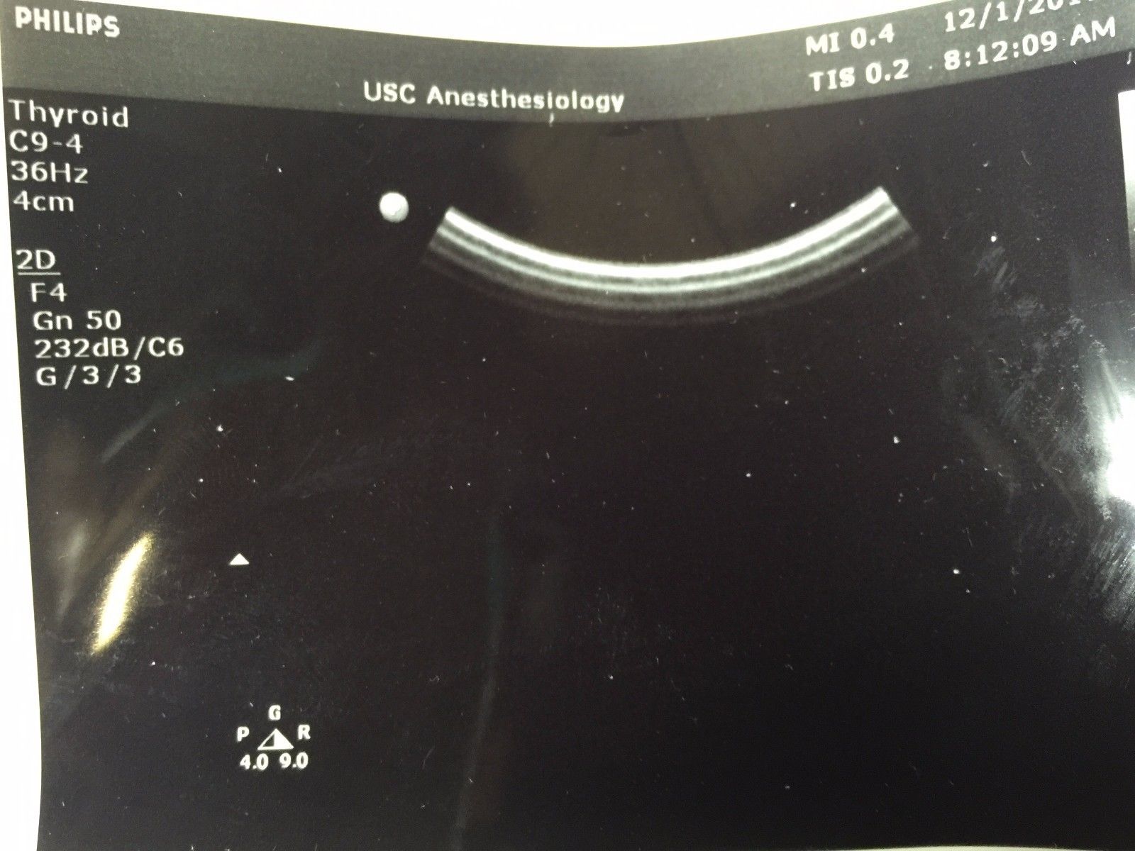 Philips C9-4 Convex Ultrasound Transducer  for Philips iU22 Systems DIAGNOSTIC ULTRASOUND MACHINES FOR SALE