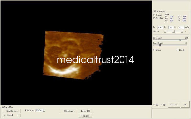 Man-Pack Ultrasound Scanner Machine 3D image With7.5MHz Linear Probe Best Seller 190891264060 DIAGNOSTIC ULTRASOUND MACHINES FOR SALE