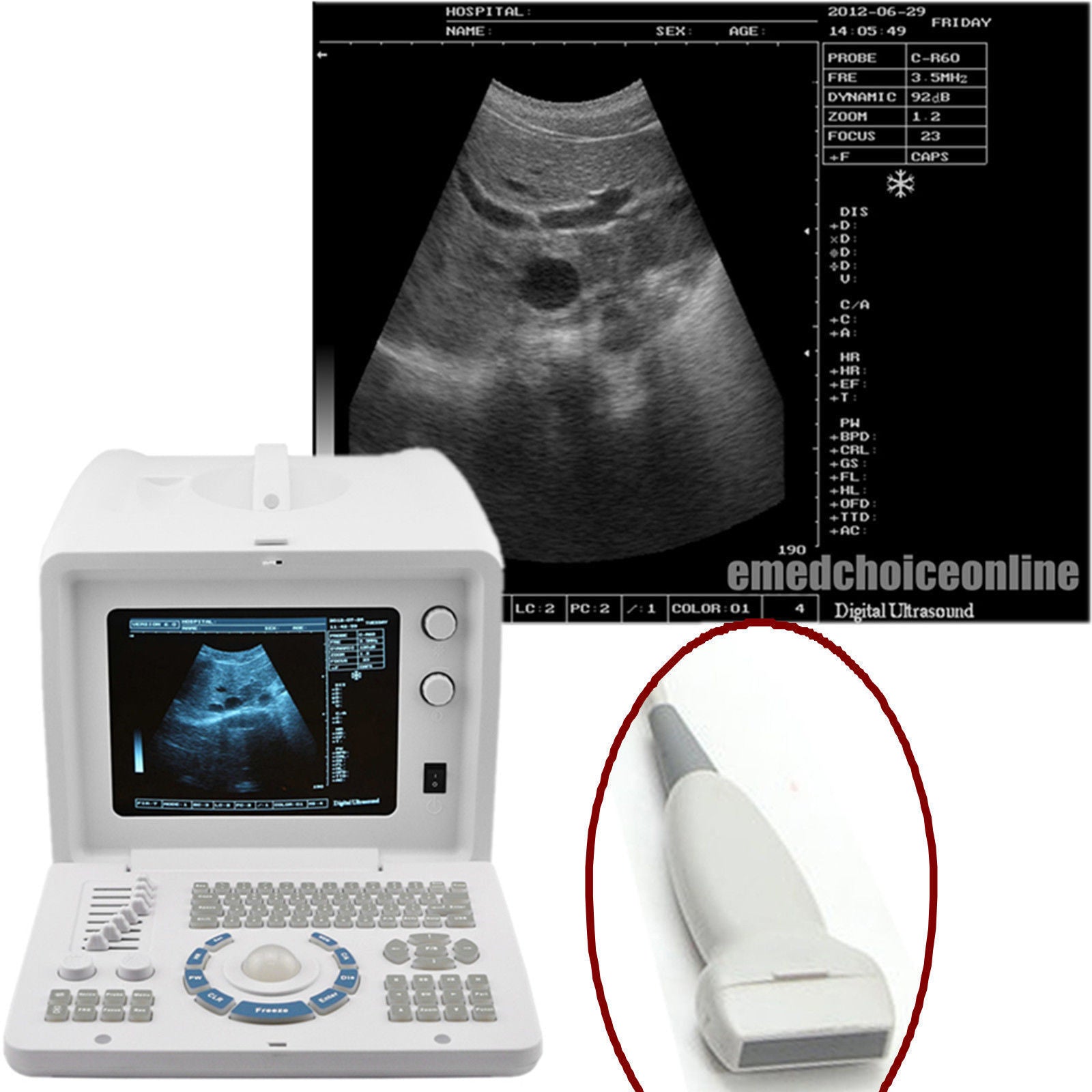 Portable Ultrasound Scanner Diagnostic 7.5 Linear Probe External 3D software MED DIAGNOSTIC ULTRASOUND MACHINES FOR SALE