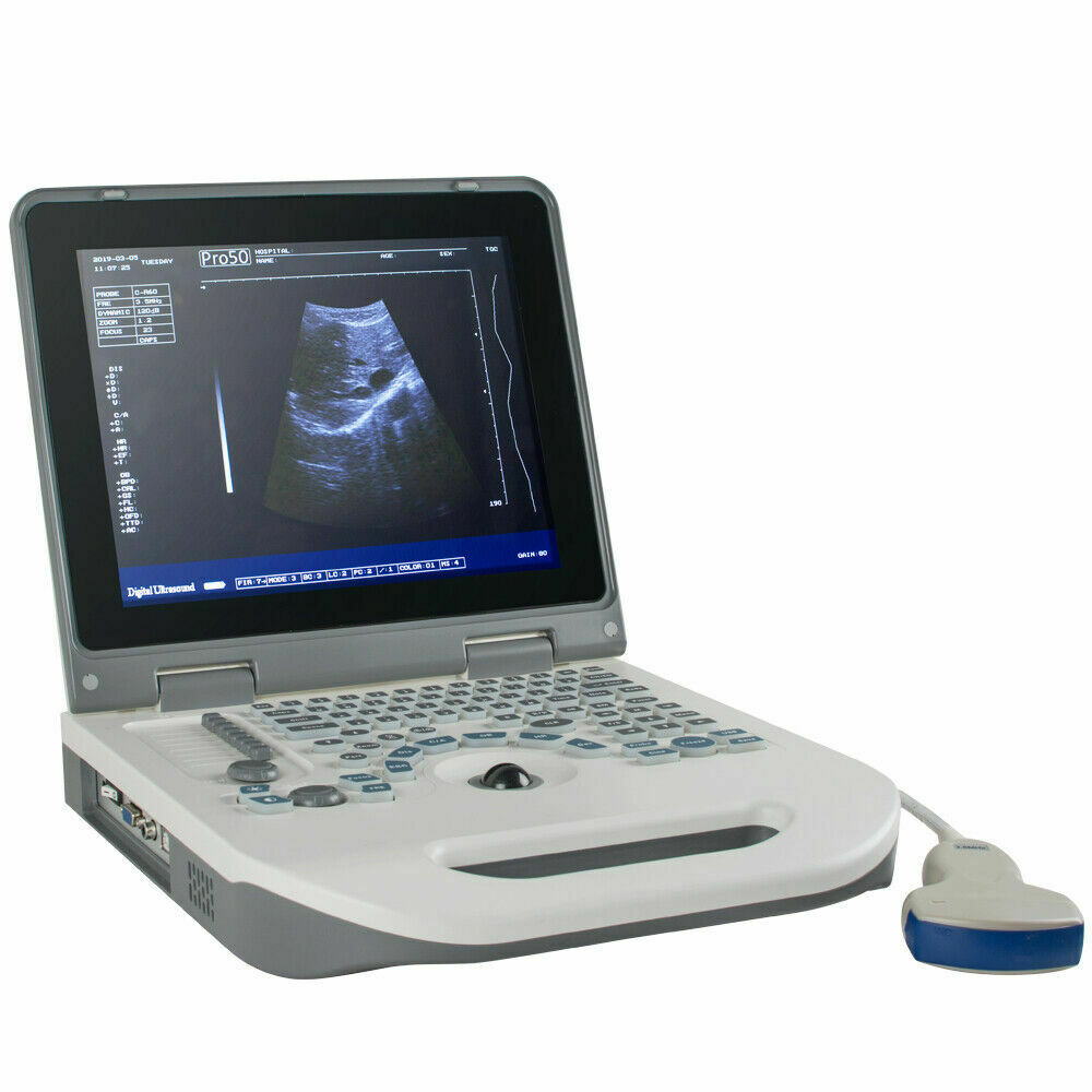 New Full Digital Ultrasound Scanner Ultrasonic MachineDisgnos Convex Probe 3D CE DIAGNOSTIC ULTRASOUND MACHINES FOR SALE