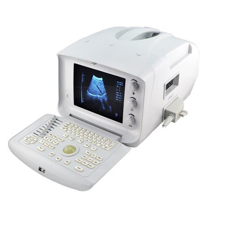 Digital Ultrasound Scanner/Machine 3.5Mhz Convex Transducer/Probe 3D A+ DIAGNOSTIC ULTRASOUND MACHINES FOR SALE