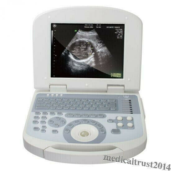 Portable Human Digital Laptop Ultrasound Scanner Machine System Convex Probe 3D DIAGNOSTIC ULTRASOUND MACHINES FOR SALE