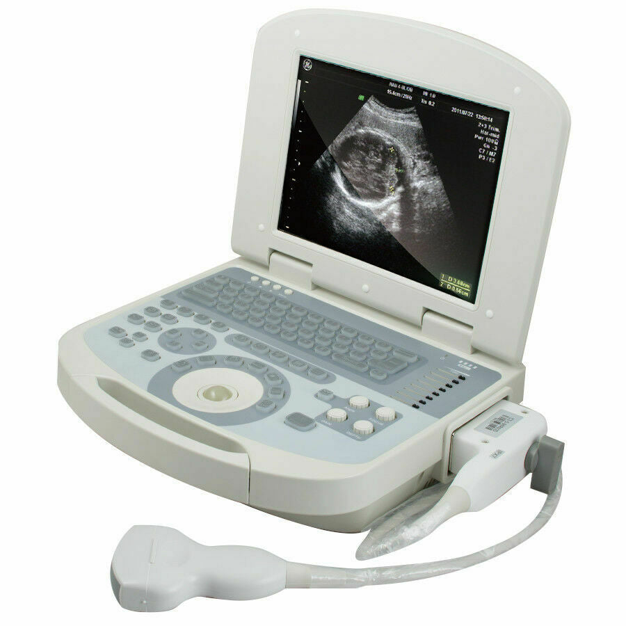 New Portable Notebook Digital Laptop Machine Ultrasound Scanner Convex Probe+3D DIAGNOSTIC ULTRASOUND MACHINES FOR SALE
