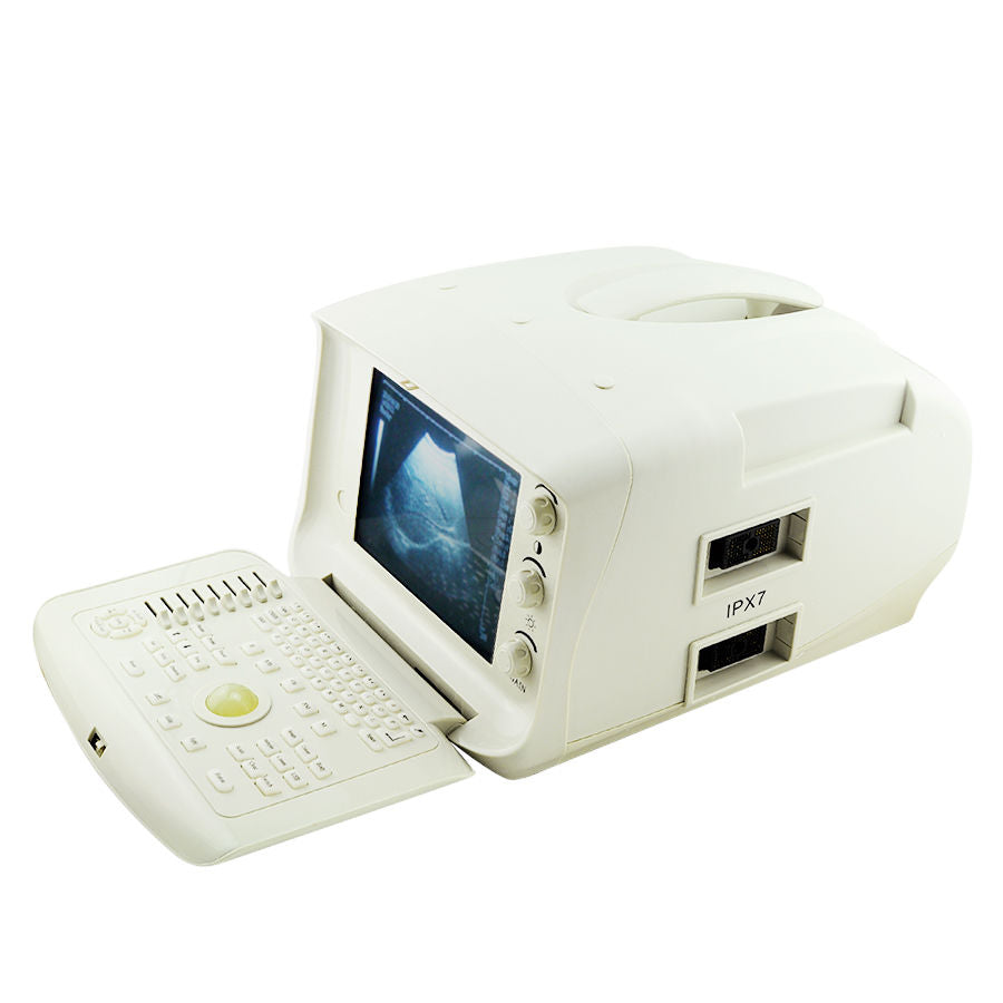 Digital Portable Ultrasound Scanner Linear Probes/Sensors with 3D Worksation CE 190891353023 DIAGNOSTIC ULTRASOUND MACHINES FOR SALE