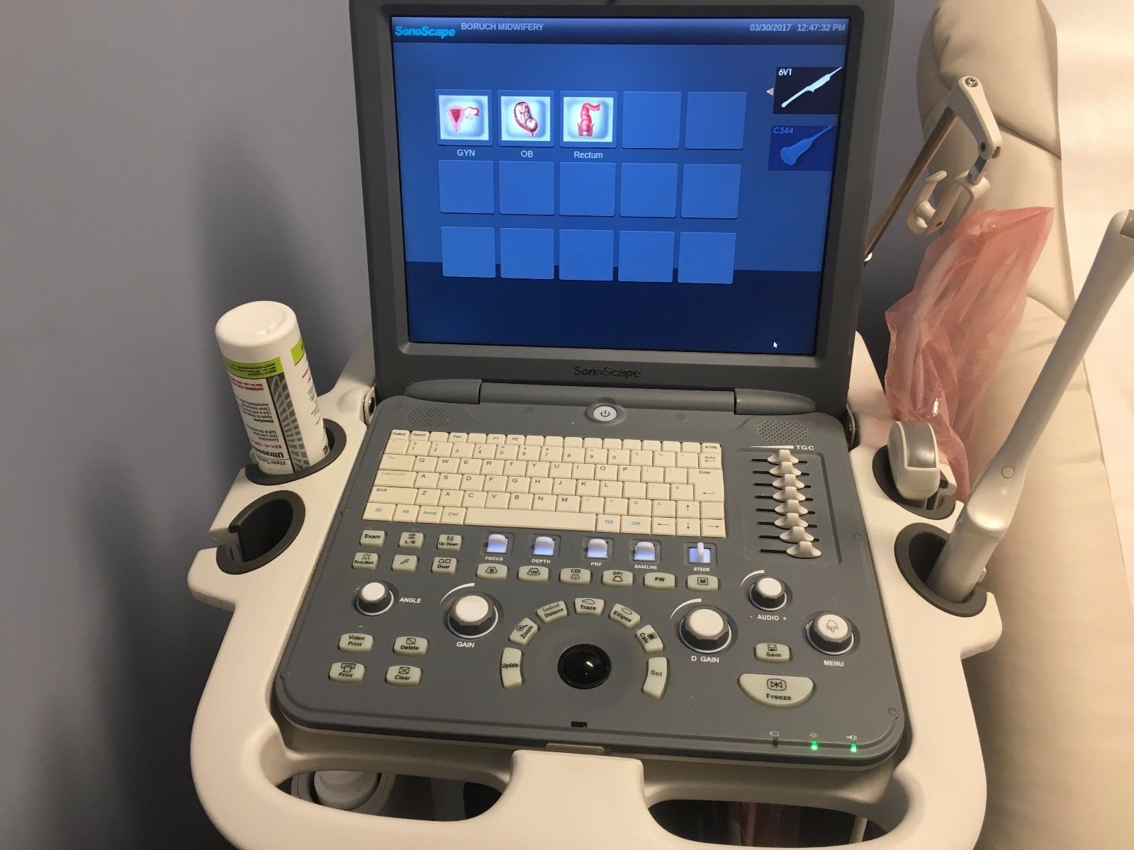 SonoScape S2 2013 Portable Ultrasound System Machine Used 1st owner 2 Probes DIAGNOSTIC ULTRASOUND MACHINES FOR SALE