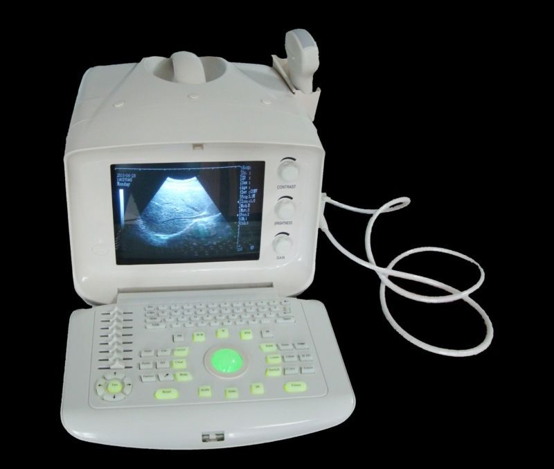 Digital Ultrasound Scanner Machine Convex +Linear 2 Probes Free 3D Software CE 190891732316 DIAGNOSTIC ULTRASOUND MACHINES FOR SALE