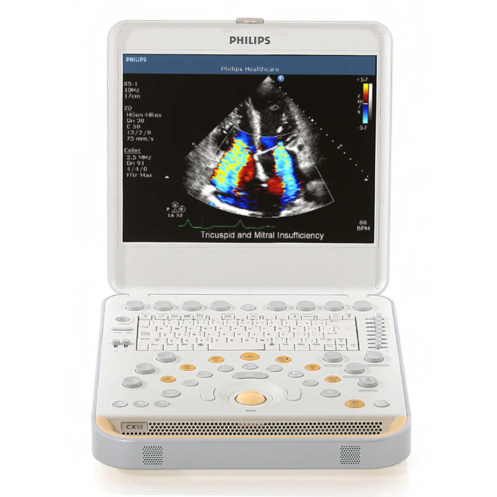 Philips CX50 Portable Ultrasound System with S5-1 Cardiac Sector Transducer DIAGNOSTIC ULTRASOUND MACHINES FOR SALE