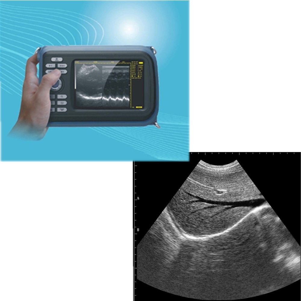 Digital laptop Machine HandScan Ultrasound scanner Convex + Transvaginal Probe 190891758668 DIAGNOSTIC ULTRASOUND MACHINES FOR SALE