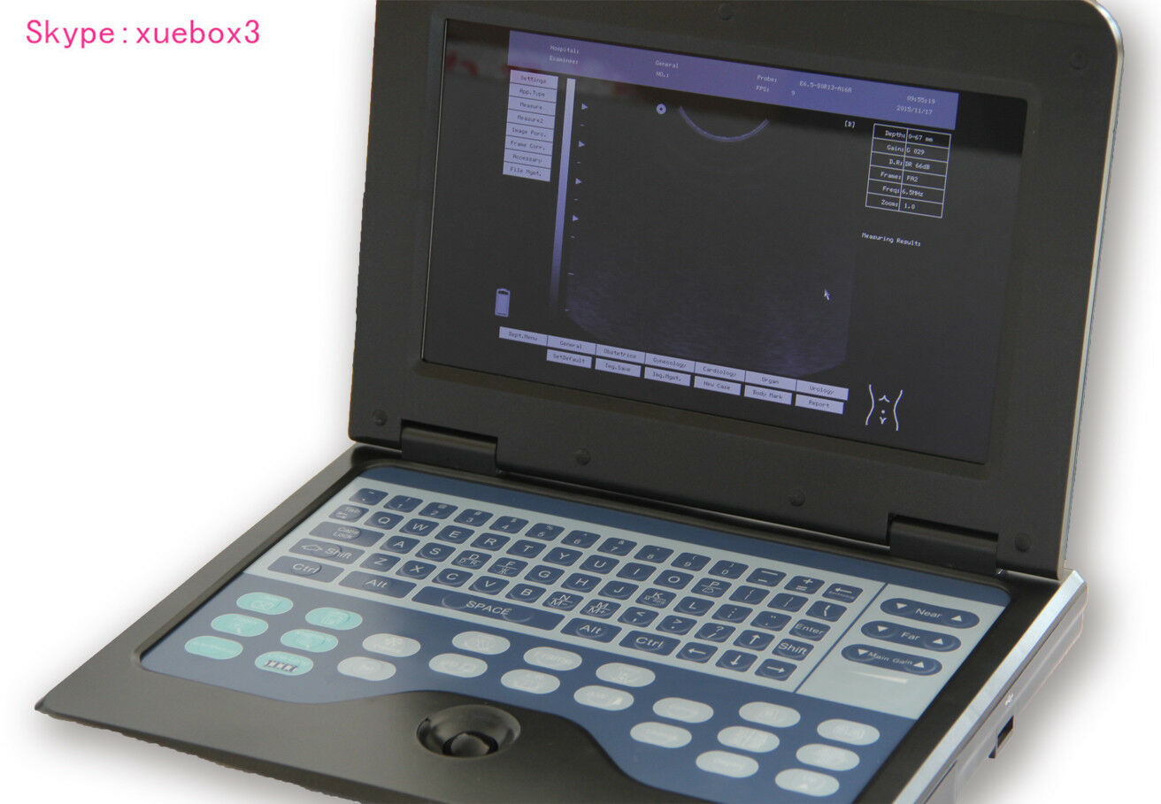 Portable ultrasound scanner laptop machine 3 Probes Convex/ Linear/ Transvaginal DIAGNOSTIC ULTRASOUND MACHINES FOR SALE