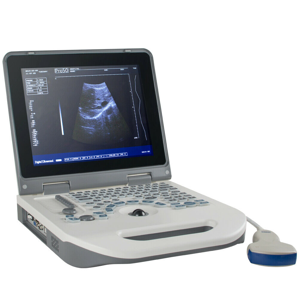 Portable Digital Ultrasound Scanner machine Abdomen Baby Convex Probe + 3D Pack DIAGNOSTIC ULTRASOUND MACHINES FOR SALE