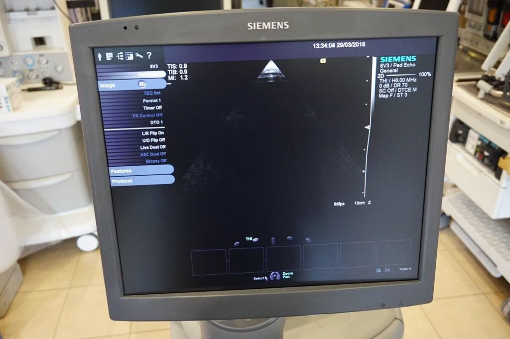 Siemens Acuson S2000 Cardiac Ultrasound system with 3 transducers DIAGNOSTIC ULTRASOUND MACHINES FOR SALE
