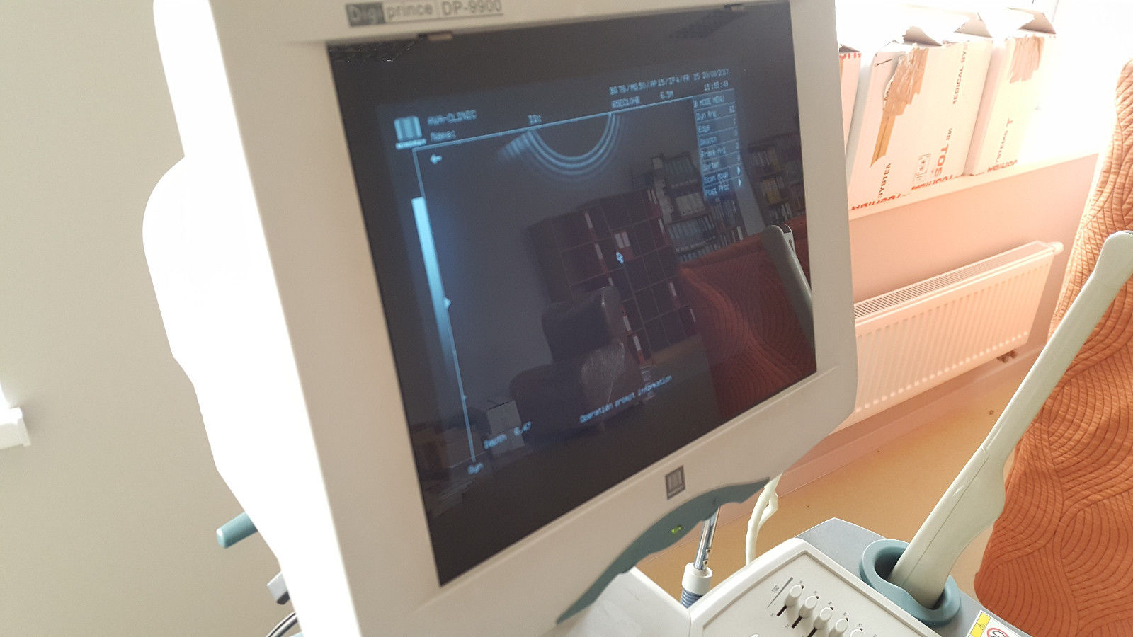 Mindray DP-9900 Diagnostic Ultrasound System GYN/OB DIAGNOSTIC ULTRASOUND MACHINES FOR SALE