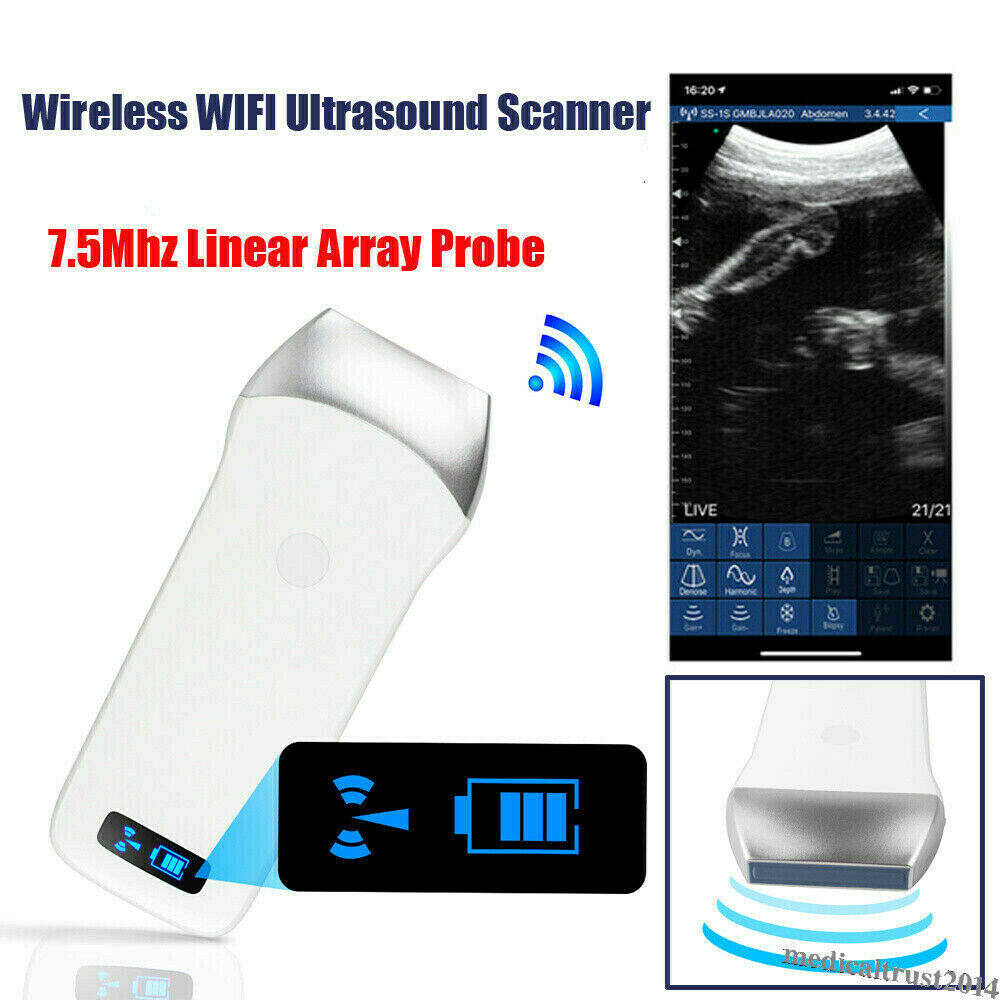 Portable WIFI Wireless Ultrasound Scanner Machine System Linear Probe 7.5Mhz 80E DIAGNOSTIC ULTRASOUND MACHINES FOR SALE