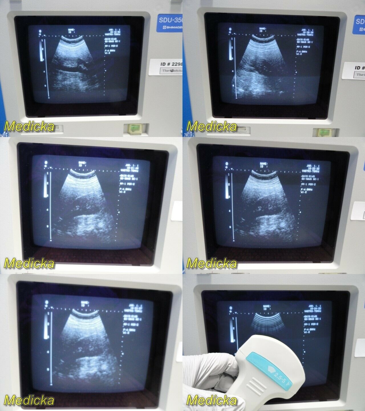 Shimadzu VA57R-0375U Convex Array Ultrasound Transducer Probe *TESTED* ~ 25474 DIAGNOSTIC ULTRASOUND MACHINES FOR SALE