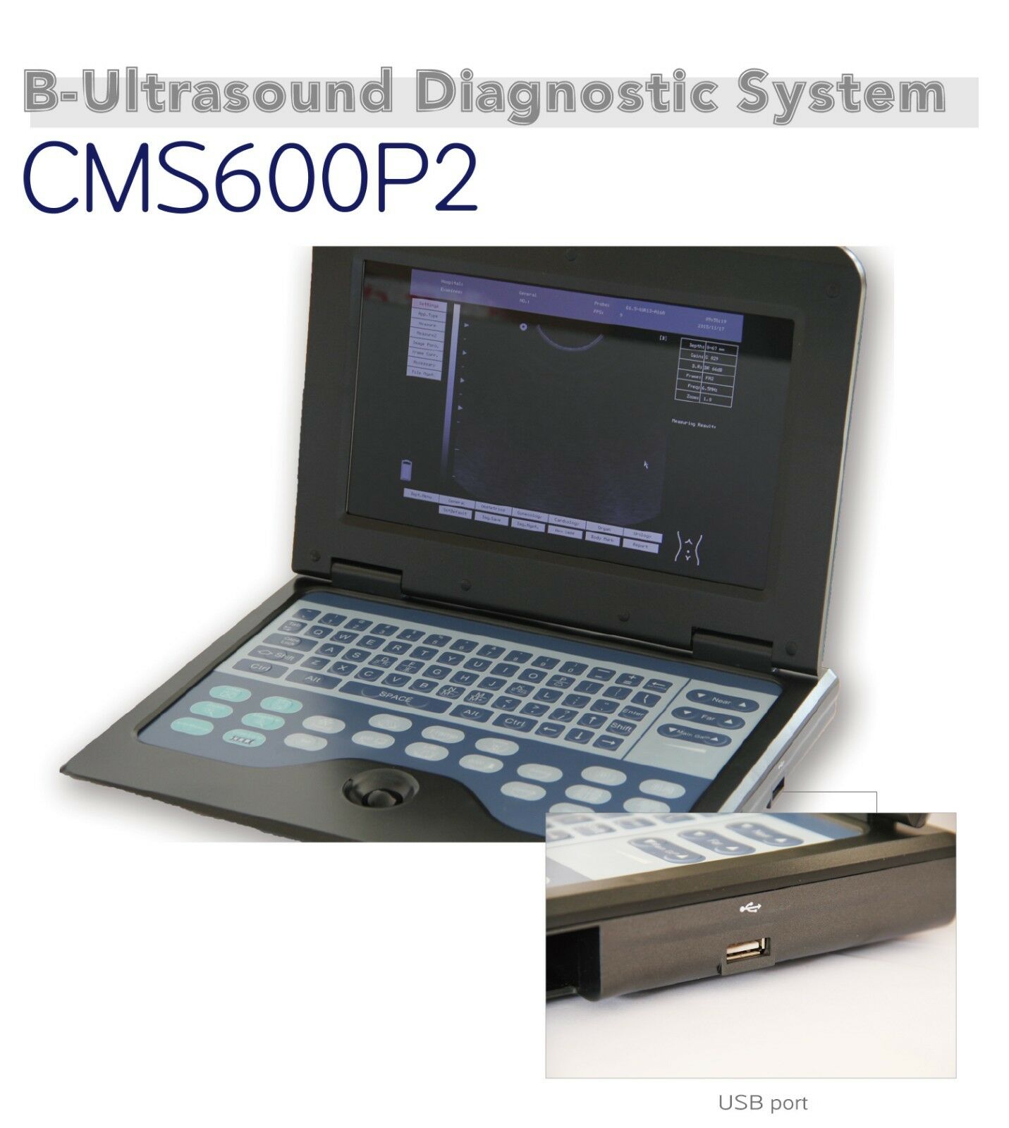 Portable Laptop Digital Ultrasound Scanner High Resolution,Convex/abdominal Prob DIAGNOSTIC ULTRASOUND MACHINES FOR SALE