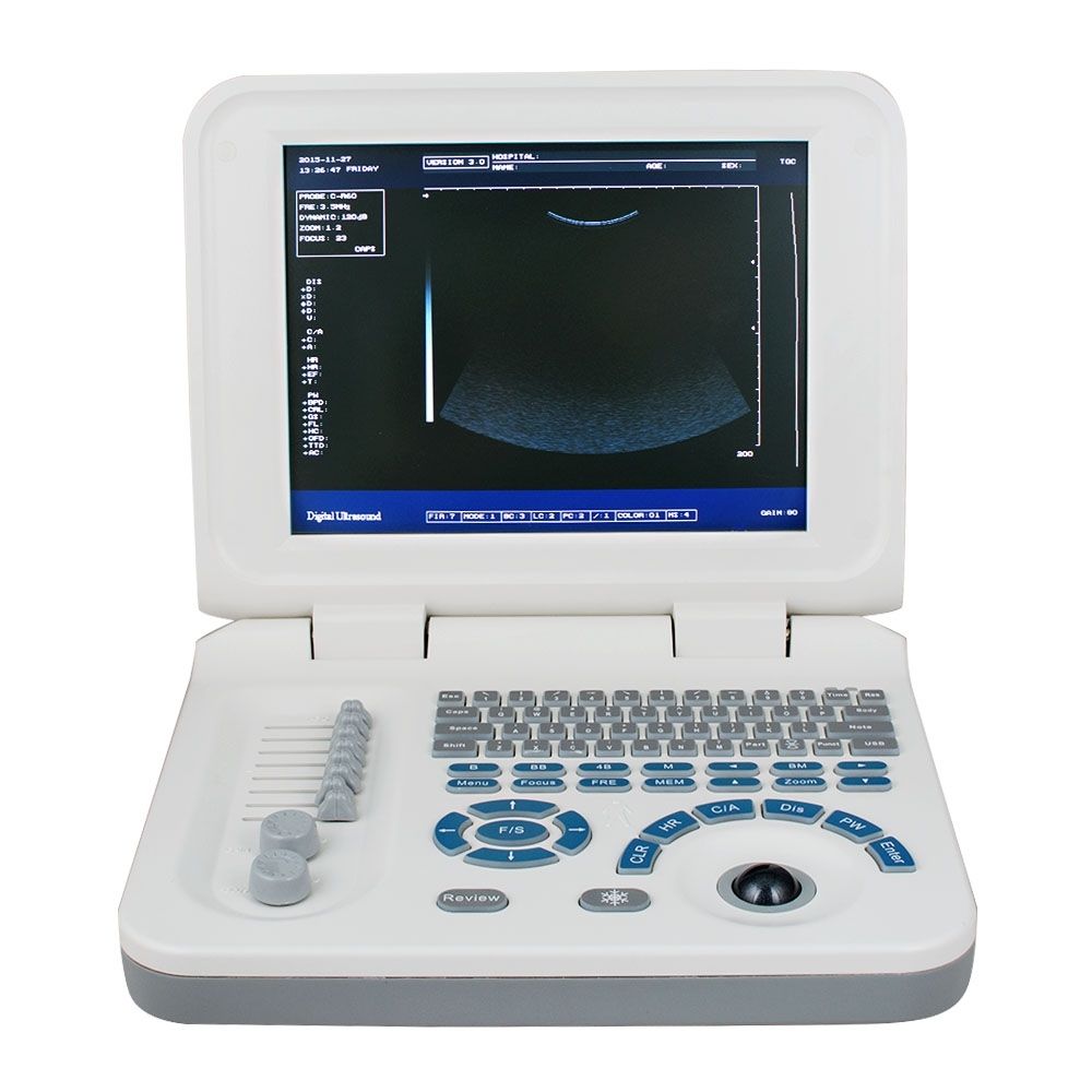 LCD Digital Ultrasound Scanner Monitor Device +Micro-convex  Array probe + Bag 190891494238 DIAGNOSTIC ULTRASOUND MACHINES FOR SALE