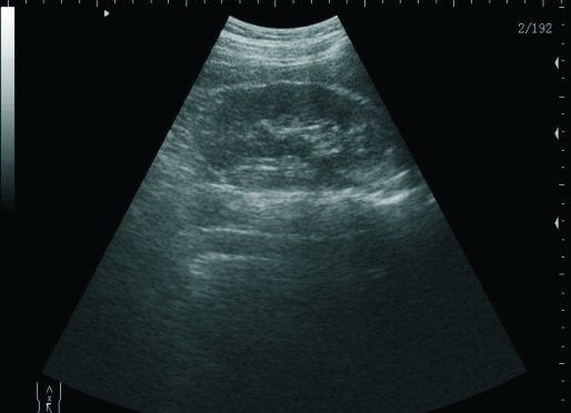 Laptop Ultrasound Scanner Diagnostic DiagnosisMachine Convex Probe Sale CE DIAGNOSTIC ULTRASOUND MACHINES FOR SALE