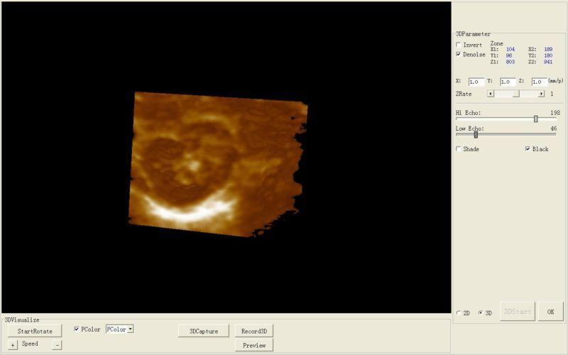 High Quality Veterinary Portable Ultrasound Scanner Machine + Rectal Probe +CE DIAGNOSTIC ULTRASOUND MACHINES FOR SALE